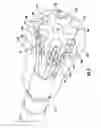 Fig. 05 - Internal body cavity therapeutic applicators and methods for using them