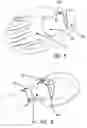 Fig. 04 - Apparatus and method for an improved hand fin