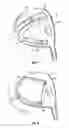 Fig. 05 - Golf club head with adjustable center of gravity