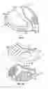 Fig. 06 - Golf club head with adjustable center of gravity