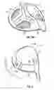 Fig. 07 - Golf club head with adjustable center of gravity