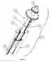 Fig. 04 - Injection Lance Assembly