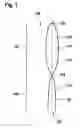 Fig. 02 - Film bag for a microfluidic analysis system, microfluidic analysis system, method for producing and method for operating a microfluidic analysis system
