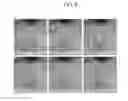 Fig. 07 - Microfluidic device and control equipment for microfluidic device