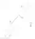 Fig. 05 - Hammer tacker