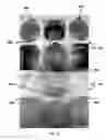 Fig. 09 - PEELABLE PACKAGE