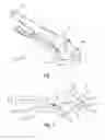 Fig. 02 - Tire bead holding pliers