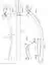 Fig. 09 - Leaf spring and leaf spring assembly