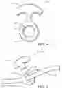 Fig. 05 - Conductor winding tool and battery charger having the same
