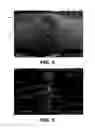 Fig. 05 - Hitch angle detection for trailer backup assist system using multiple imaging devices