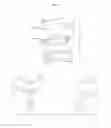 Fig. 02 - Rear backup sideview mirror assembly
