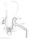 Fig. 01 - Side air bag device