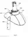 Fig. 35 - Dual steerable vehicle
