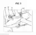 Fig. 04 - Knee braces for boats
