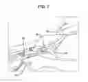 Fig. 08 - Knee braces for boats
