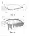 Fig. 08 - Propeller blade leading edge serrations for improved sound control