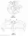 Fig. 02 - Propulsion unit for an aircraft and method for opening a movable cowl of said propulsion unit