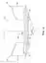 Fig. 12 - Valve assembly for a drinking cup and a drinking cup having a valve assembly