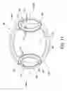 Fig. 13 - Valve assembly for a drinking cup and a drinking cup having a valve assembly