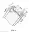 Fig. 17 - Valve assembly for a drinking cup and a drinking cup having a valve assembly