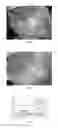 Fig. 07 - Easy pouring packaging pouch