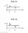 Fig. 10 - Inter-roller conveyance control device