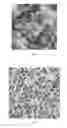 Fig. 02 - Biological composite material loaded with magnetic nanoparticles with core-shell structure, the preparation therefore and the application