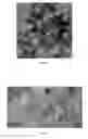 Fig. 03 - Biological composite material loaded with magnetic nanoparticles with core-shell structure, the preparation therefore and the application