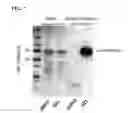 Fig. 08 - Compounds and methods for inhibiting vacuolar ATPase