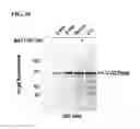 Fig. 11 - Compounds and methods for inhibiting vacuolar ATPase