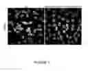Fig. 04 - NAT10 modulators for treating or preventing laminopathies, aging and cancer
