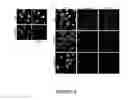 Fig. 06 - NAT10 modulators for treating or preventing laminopathies, aging and cancer