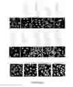 Fig. 07 - NAT10 modulators for treating or preventing laminopathies, aging and cancer