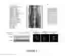 Fig. 09 - NAT10 modulators for treating or preventing laminopathies, aging and cancer