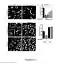 Fig. 11 - NAT10 modulators for treating or preventing laminopathies, aging and cancer