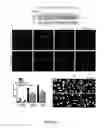 Fig. 12 - NAT10 modulators for treating or preventing laminopathies, aging and cancer