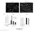 Fig. 17 - NAT10 modulators for treating or preventing laminopathies, aging and cancer