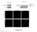 Fig. 28 - NAT10 modulators for treating or preventing laminopathies, aging and cancer