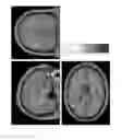 Fig. 01 - Compositions and methods for treating neurodegenerative diseases