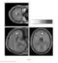 Fig. 03 - Compositions and methods for treating neurodegenerative diseases