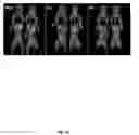 Fig. 30 - Bi-terminal pegylated integrin-binding peptides and methods of use thereof