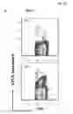 Fig. 08 - Recombinant Bacterium and Uses Thereof