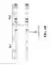 Fig. 06 - Peptide inhibitors of BCR-ABL oligomerization