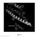 Fig. 07 - Peptide inhibitors of BCR-ABL oligomerization
