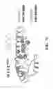 Fig. 10 - Peptide inhibitors of BCR-ABL oligomerization
