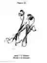 Fig. 48 - ANTIBODIES WITH MODIFIED ISOELECTRIC POINTS
