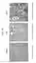 Fig. 02 - METHOD FOR TREATING ANTIBODY-MEDIATED REJECTION POST-TRANSPLANTATION