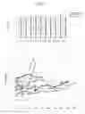 Fig. 13 - METHOD FOR TREATING ANTIBODY-MEDIATED REJECTION POST-TRANSPLANTATION