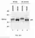 Fig. 40 - TIKI INHIBITORS