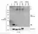 Fig. 49 - TIKI INHIBITORS